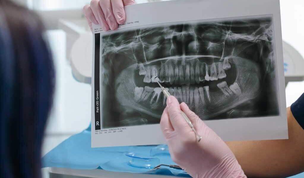 plano-odontologico-corporativo-radiografia-nordica