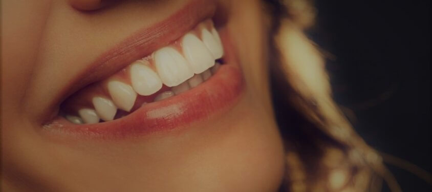 sorrir